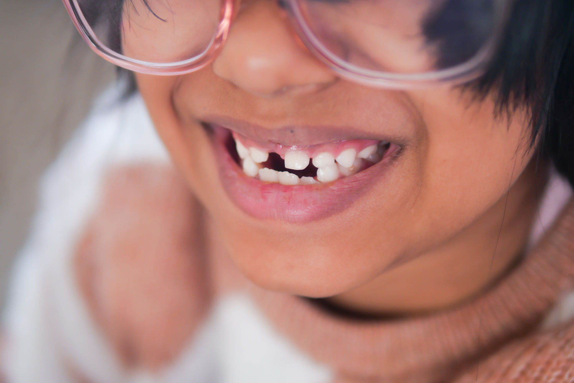 detail shot of child with teeth missing